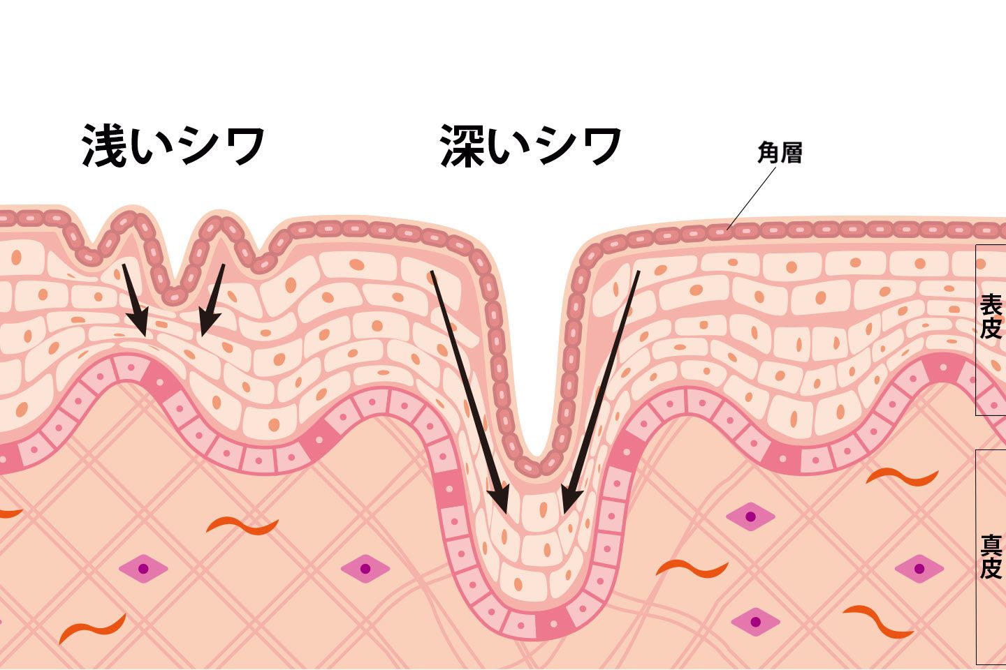 しわ_1