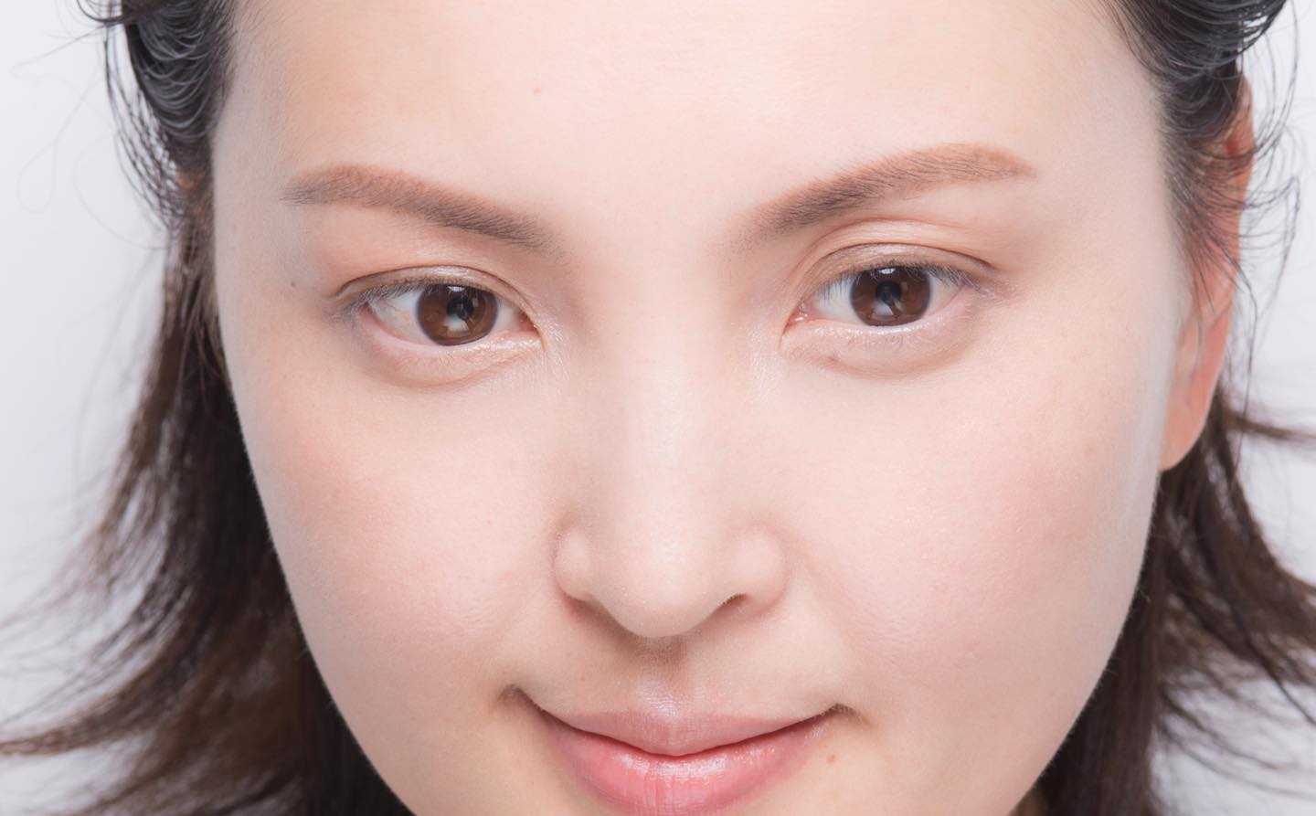右目と比べて左目のまぶたが落ちくぼんでいるので、正面から見たときに、アンバランスな印象に…。
